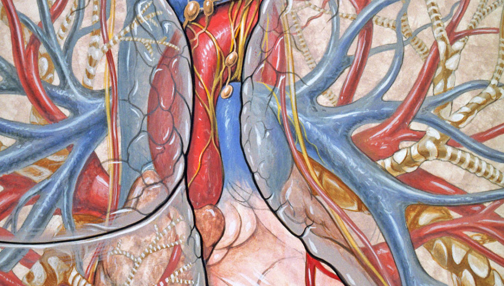 sindrome coronarica acuta